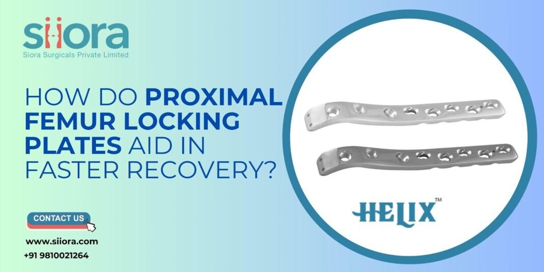 How Do Proximal Femur Locking Plates Aid in Faster Recovery? Locking Plates